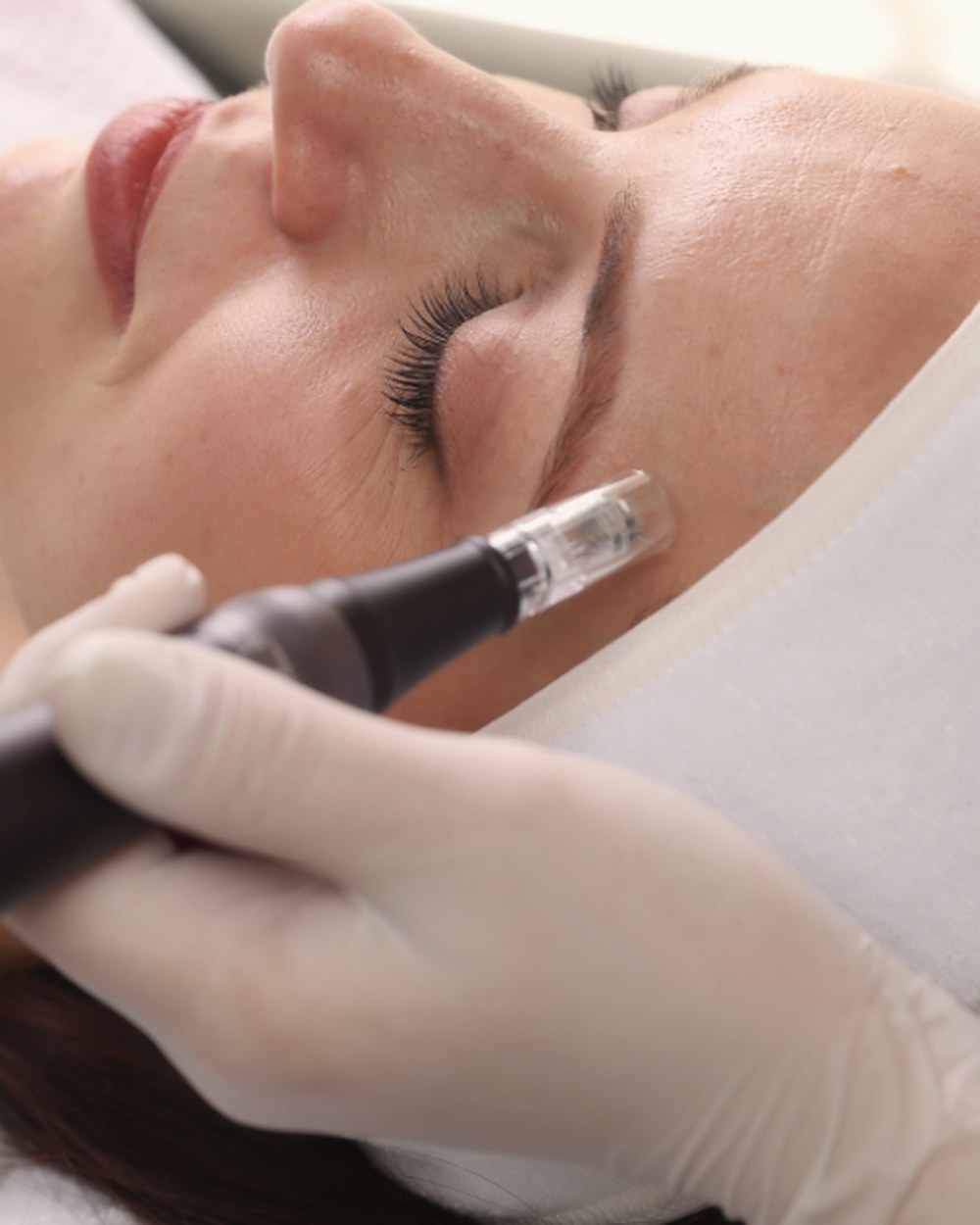 Profi Micro-Needling im Kosmetikstudio Gema Frias in Bremen