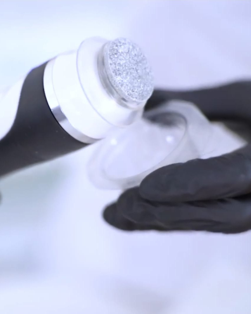 Skin OXYmizer Handstück mit Diamant-Peeling-Aufsatz